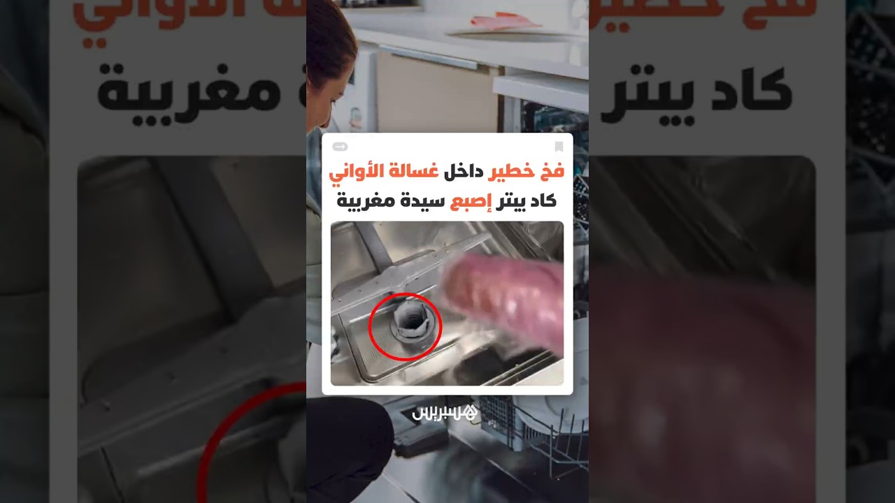 "دون حماية".. مغربية تكشف كيف كاد تنظيف آلة غسل الأواني أن يكلفها إصبعها وتوجه تحذيرا عاجلا thumbnail