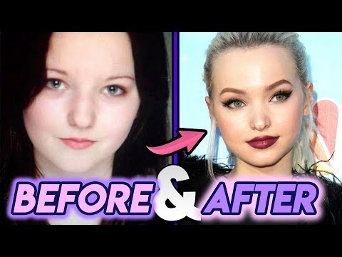 download lagu mp3 mp4 Dove Cameron Surgery, download lagu Dove Cameron Surgery gratis, unduh video klip Dove Cameron Surgery