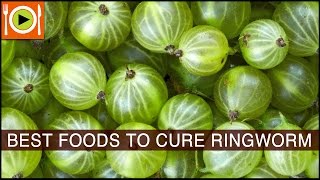 Best Foods to  Cure Ringworm | Including Vitamin A, Vitamin C & Vitamin E Rich Foods