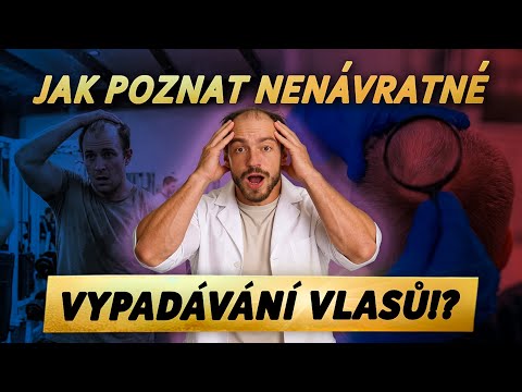 Jak poznat, že ti NENÁVRATNĚ padají VLASY?