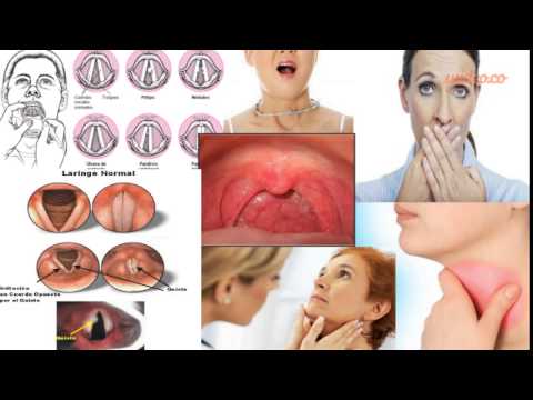 Técnica Vocal Jerson - by Wideo.co