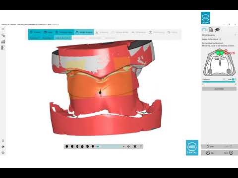 BDCreator PLUS: Construction full upper and lower  (en) | #BalticDentureSystem #DigitalDenture