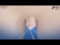 Circumcision Using The Mogen Technique Animation