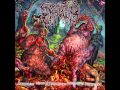 Epicardiectomy- Abhorrent Stench of Posthumous ...