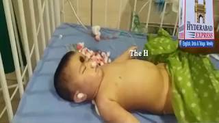 One More Innocent Boy died due to Negligence of Doctors of Niloufer Hospital.