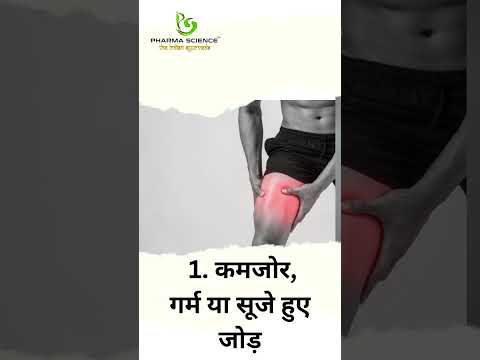 जोड़ों के दर्द के संकेत और लक्षण क्‍या-क्‍या हैं?  #aurveda #fact #ayurvediccompany