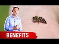 Bee Sting Therapy