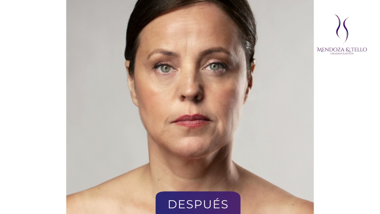 Alexander Mendoza-95