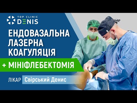 Флебология в клинике ДЕНИС: малоинвазивные процедуры для лечения варикоза