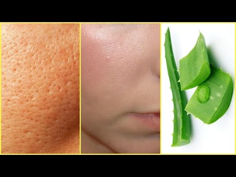 How To Get Rid Of Large Pores │Smooth, Tight, Young Skin NATURALLY │ Pores & Blackheads Disappear Video