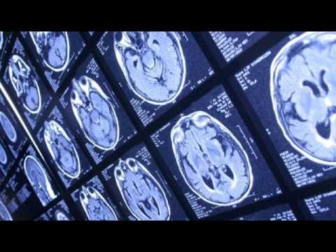 When memory loss is and isn't normal