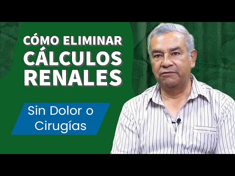 Cómo eliminar los cálculos renales sin dolor o cirugías