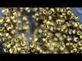 spiderling ball (black and yellow garden spiders ...