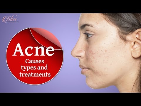 Medical Acne Recovery Guide