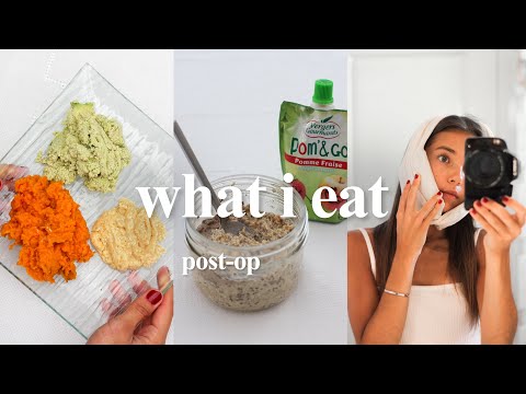WHAT I ATE AFTER WISDOM TEETH REMOVAL | vegan, soft & quick meals!