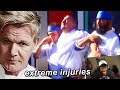 The Most Brutal Accidents In Hell S Kitchen History