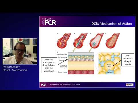 Paclitaxel and sirolimus coated balloons: create evidence before claims - EuroPCR 2021