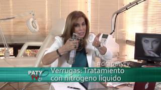 Tratamientos para las verrugas - Dra. Paty tv