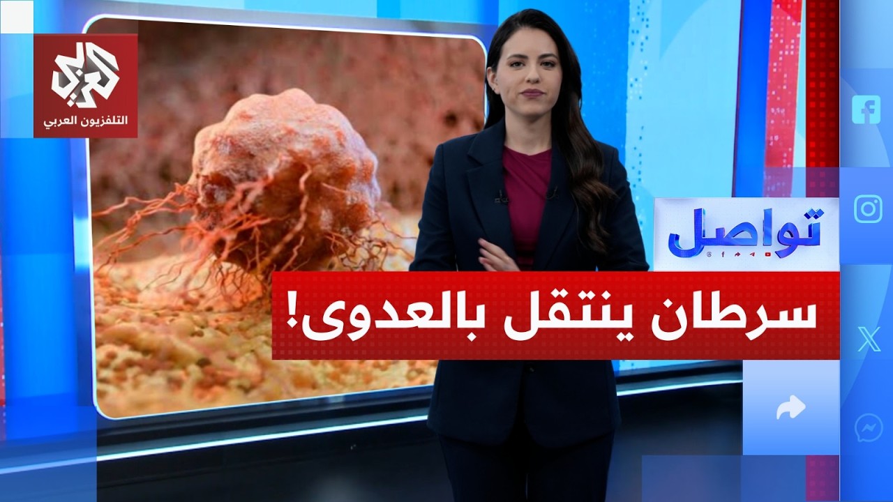 "اكتشاف نوع سرطان ينتقل بالعدوى.. هل يقضي على البشر؟ | تواصل