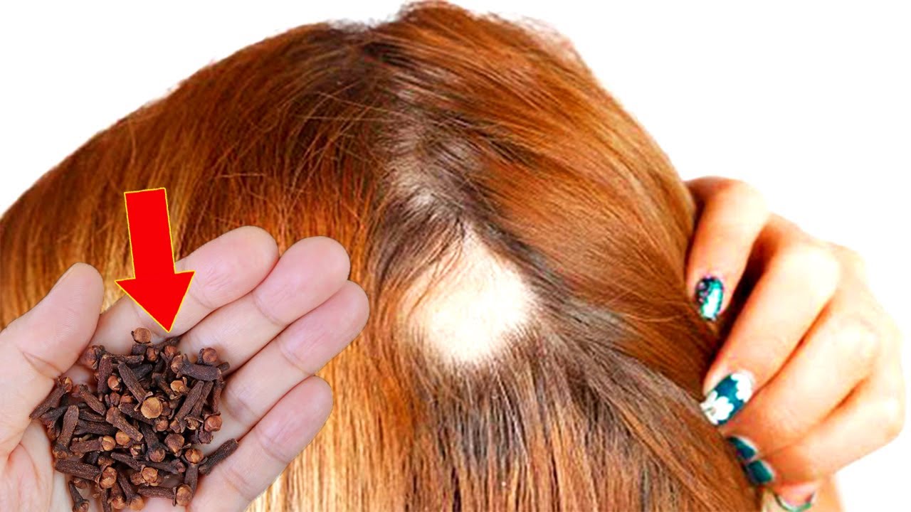 Put cloves in your hair and stop spending money at the pharmacy (Did you know that?)