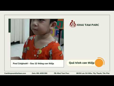 Hành trình thay đổi của em Paul Zolghadri