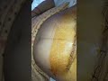 Dressing For Cesarean Patient Dressing Technique
