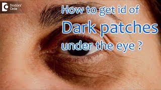 How can you get rid of black spots under the eye? - Dr. Arti Priya R
