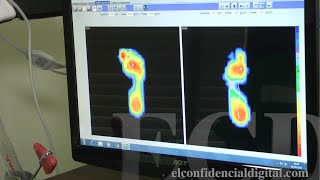Así se realiza un estudio de la pisada recomendado por los médicos para correr y caminar