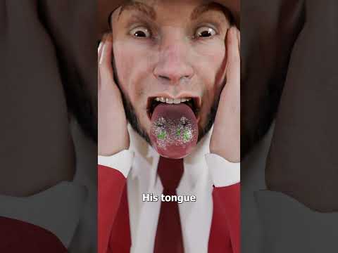 Why Did The Snake Suddenly Bite Him 😨