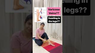 Yoga for varicose veins. #yoga #yogawithbhumikaa #varicoseveins
