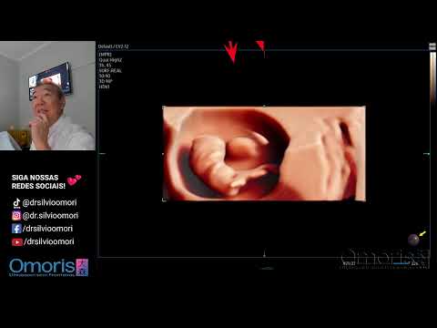 Vaginal bleeding: 8 weeks pregnant!