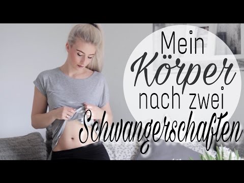 Die Salbe von der Schuppenflechte aus belorussii Die Antworten auf des Ekzems