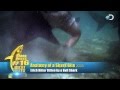 Shark Chomps Man's Leg | Shark Week's 25 Best Bites -- Shark Week 2012