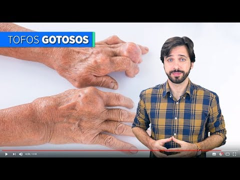 Você sabe o que é a doença Gota?