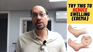 Swelling (Edema) In Ankles And Kidney Disease. 3 Tips For Improving It