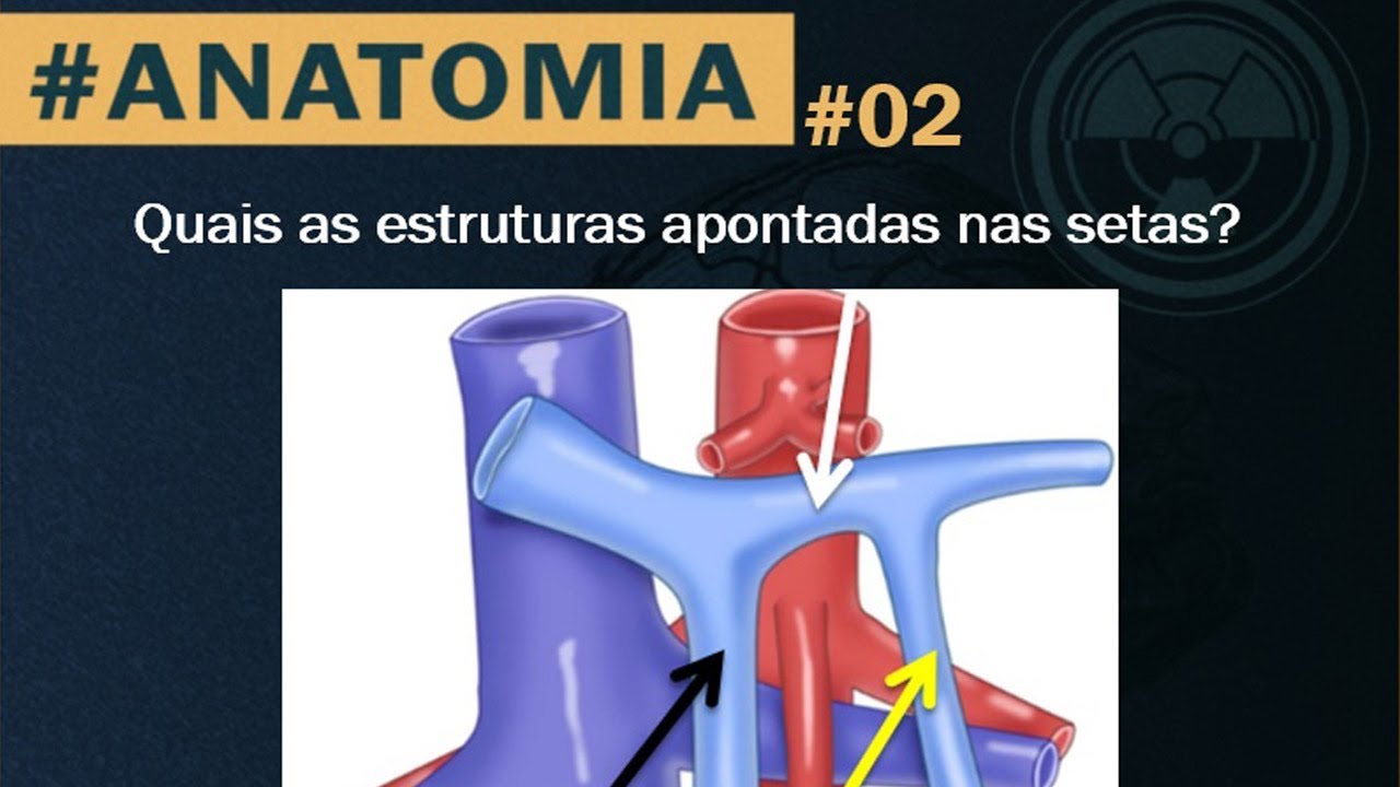 Sistema Porta Hepático - Anatomia - Dr. Ramoniê Miranda