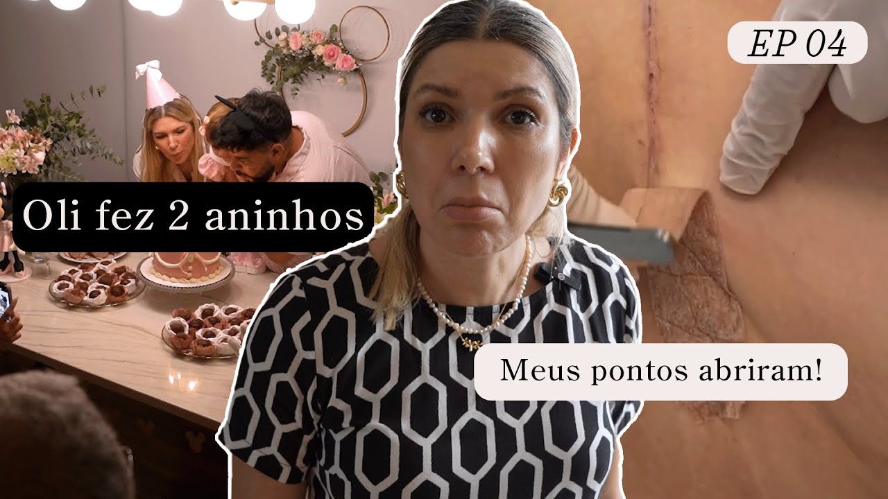 20 dias de Recuperação Cirurgia Tripla: Lipo, Abdominoplastia e Mastopexia com Protese