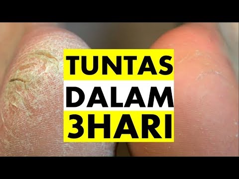 Pelangsing gadis gym Jika ada soba adalah mungkin untuk menurunkan berat badan