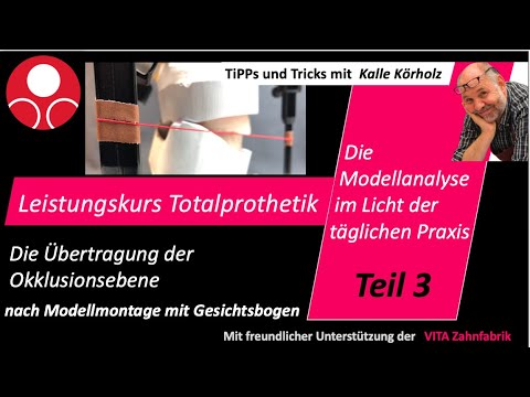 Leistungskurs Totalprothetik Teil 3 Die Okklusionsebene  nach Modellmontage mit Gesichtsbogen