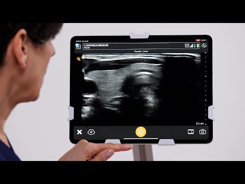Basic Thyroid Us Protocol