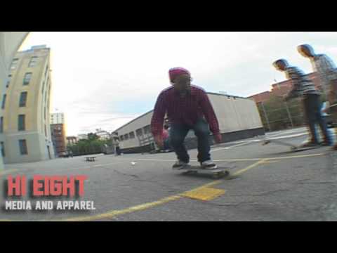 Sandy Luna: Before Surgery