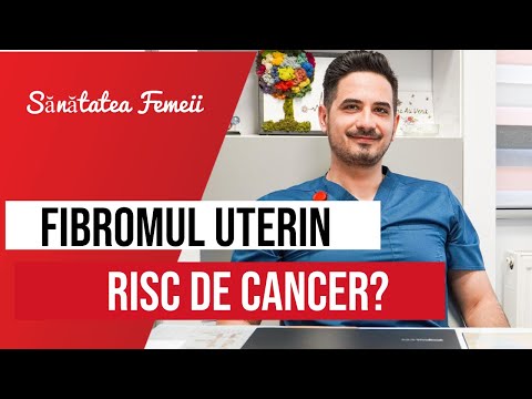 FIBROMUL UTERIN. Se poate transforma în CANCER