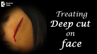 How do you treat a deep cut on face? - Dr  Pavan Murdeshwar