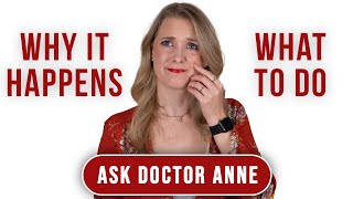 How to avoid flaky skin on the face this winter | Ask Doctor Anne