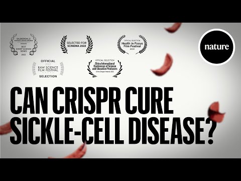 Can CRISPR cure Sickle-cell Disease?