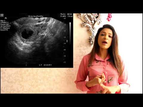 Blood Tests And Ultrasounds During Pregnancy - Part 2