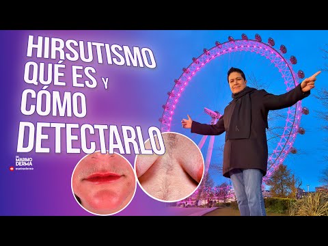 HIRSUTISMO: QUÉ ES Y CÓMO DETECTARLO