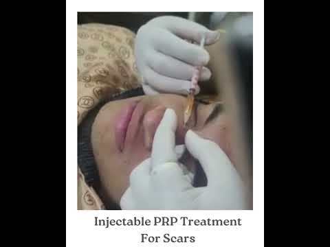 Face PRP Treatment Service