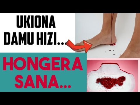 JE, Damu ni DALILI Ya MIMBA CHANGA? / #mimba #bloodduringpregnancy