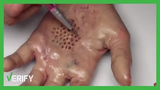 VERIFY: No, there&#39;s not a new &#39;killer bug&#39; going around spreading a deadly virus